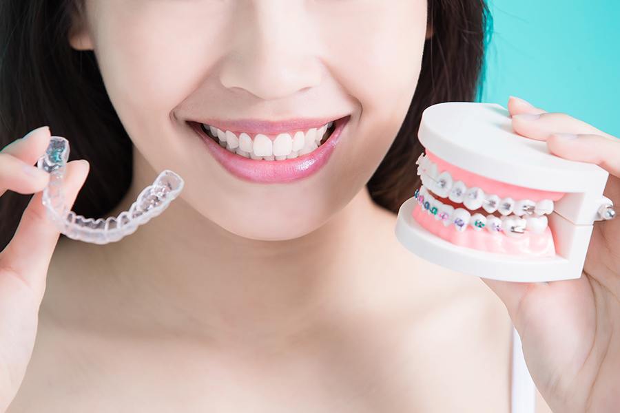 Invisalign vs. Traditional Braces