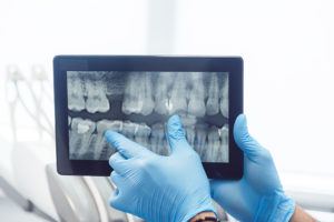 An individual displaying a dental X-ray image on a mobile tablet