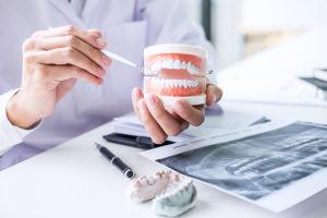 myDentalTX.com - Digital vs Traditional Dental Impressions - Improving Personalized Treatments