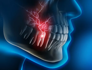 A dental X-ray graphic revealing tooth discomfort highlighted by a red electric light.