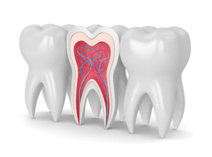 myDentalTX.com - FAQ about Root Canal Treatments