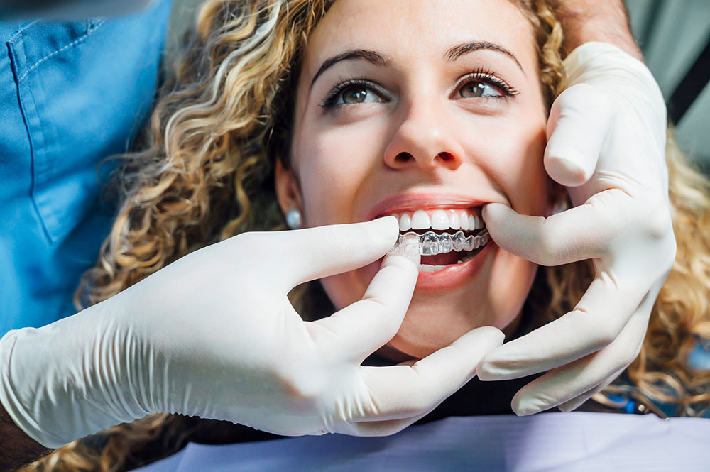 How Much Does Invisalign Typically Cost?