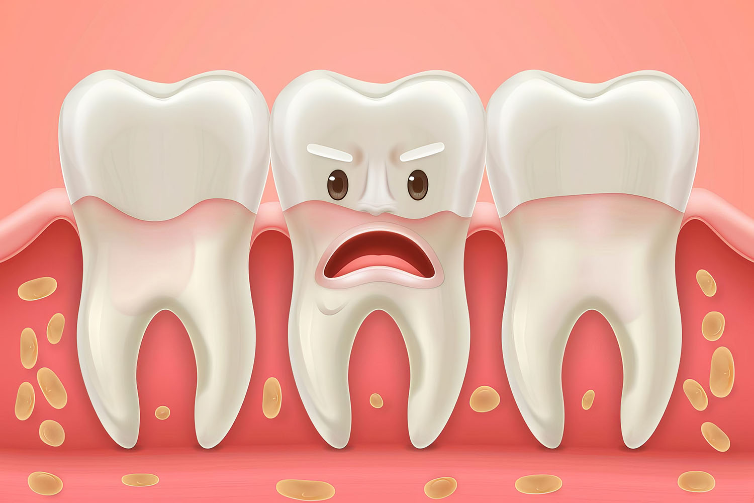 The Main Difference Between Gingivitis vs. Periodontitis myDental
