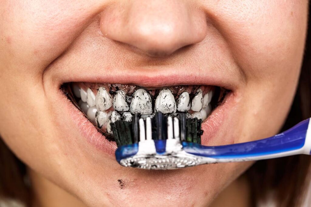 Are Charcoal Toothpastes Safe? A Look at Trending Dental Products