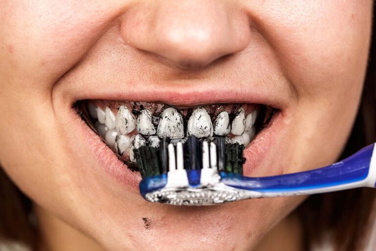 Are Charcoal Toothpastes Safe? A Look at Trending Dental Products
