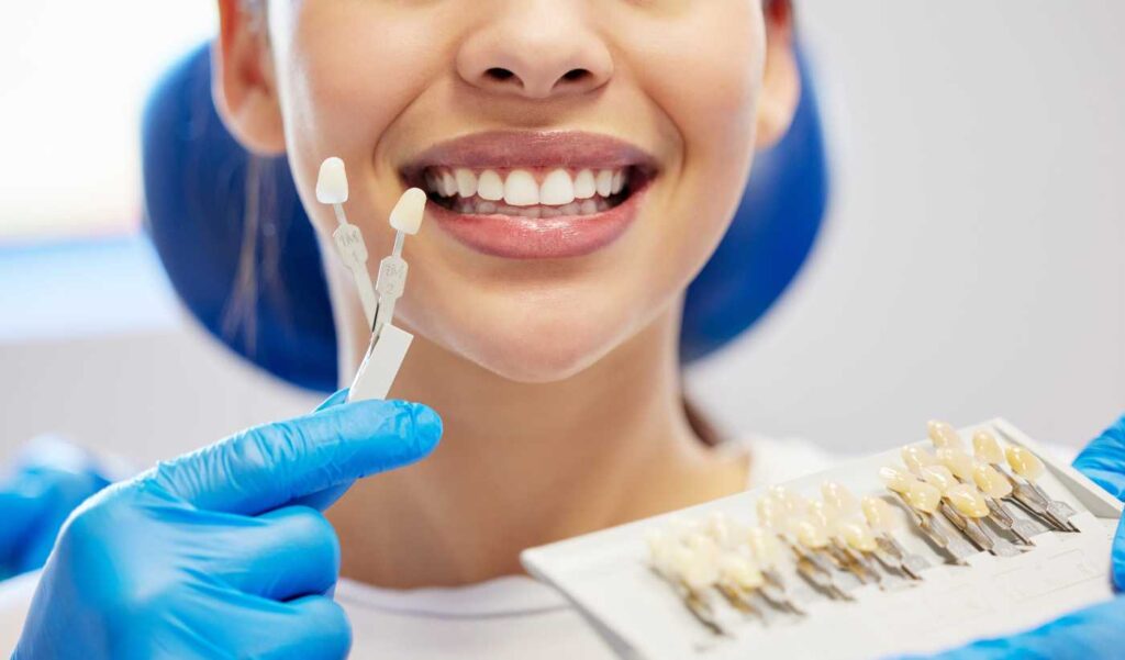 Can You Get Veneers with Crooked Teeth - Updated 2026 Guide