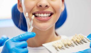 Can You Get Veneers with Crooked Teeth - Updated 2026 Guide