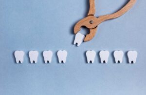 How Much Does a Tooth Extraction Cost? A Transparent Price Guide