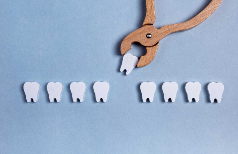 How Much Does a Tooth Extraction Cost? A Transparent Price Guide