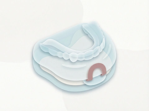 Custom orthodontic retainer for maintaining straight teeth